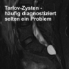 Tarlov-Zysten - häufig diagnostiziert selten ein Problem Download