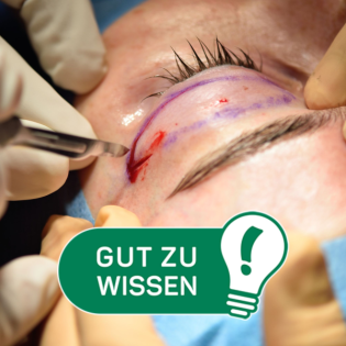 Worauf man bei Schönheitseingriffen achten sollte