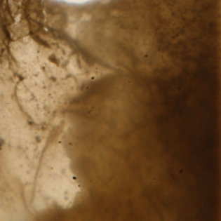 Kombucha - Bakterienzusammenkunft (19.03.25)