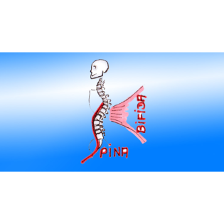 Spina bifida occulta und Spinalanästhesie