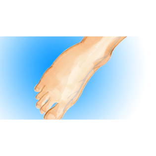 Außergewöhnlicher Gefäßzugang: V. saphena magna