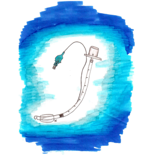 LL Prähospitales Atemwegsmanagement – Nachtrag