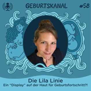 #58 Die Lila Linie auf der Haut: ein „Display“ für Geburtsfortschritt?!