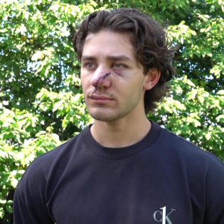 Offene Fragen nach Messerangriff in Dresden