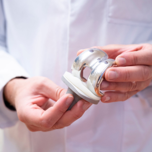 Wie lange hält die Prothese bei Arthrosepatienten?