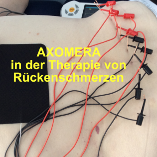 Axomera spezial - Wie kann Axomera bei Rückenschmerzen helfen