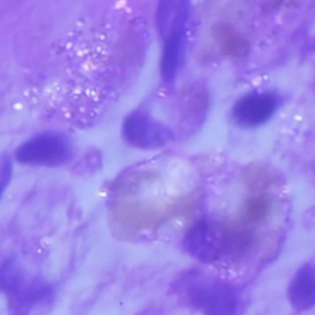 Mikroplastik im Gehirn - Wie gefährlich ist es?